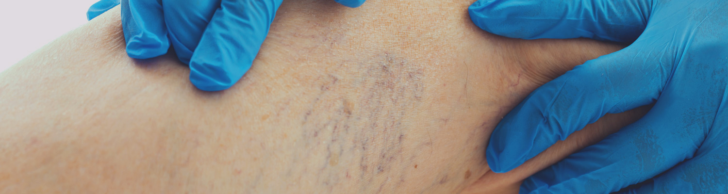 Diagnosis-Header-image